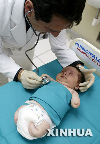 主治医生治患短肢畸形的"小美人鱼"婴儿-主治医生,,短肢,,畸形,小美人鱼,-国际