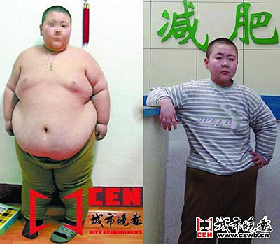 244斤"超胖"男孩成功减肥102斤