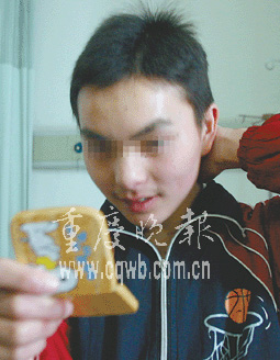 <em>高一</em><em>女生</em>竟长胡须 阴阳人决定变身男性-<em>高一</em>