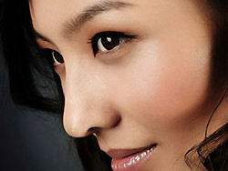 隆鼻术后会不会留疤痕-隆鼻|术后