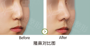 啥叫自体移植 11230547_908338.jpg