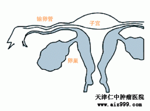 11235197_641475.gif