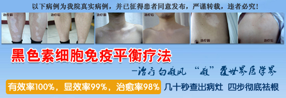 做308准分子激光照一次得多少钱啊?