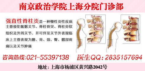 上海哪个医院看强直性脊柱炎是你的选择--每日