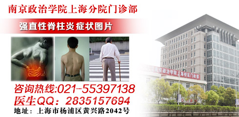 上海哪个医院看强直性脊柱炎权威--每日甘肃-科