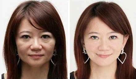 怎样快速解决脸上皱纹 11630681_696701.jpg