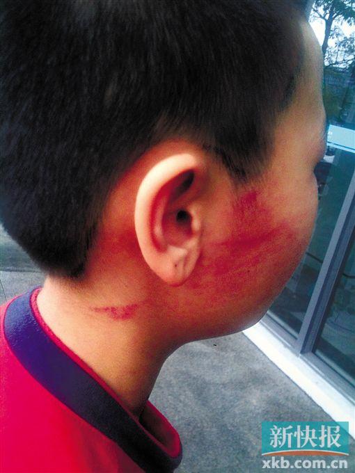 广东:贵族学校一小学生骂老师被连扇数个耳光