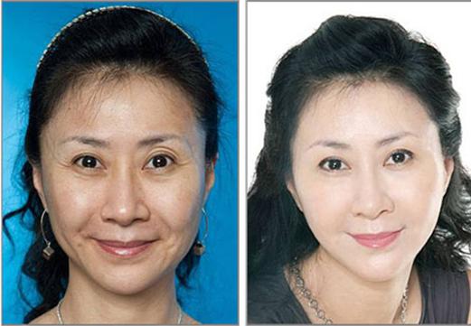 台江整形申涛教授获得瑞士抗衰老协会专家授权证书