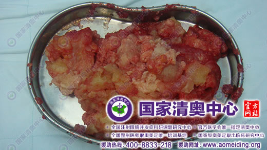 奥美定