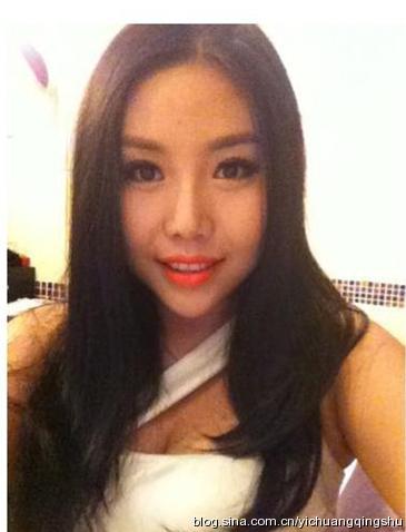 大变脸!江映蓉张冬玲等超女整容后PK(图)-整容